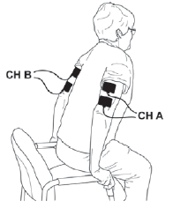 Functional electrical stimulation (FES) in orthopaedics